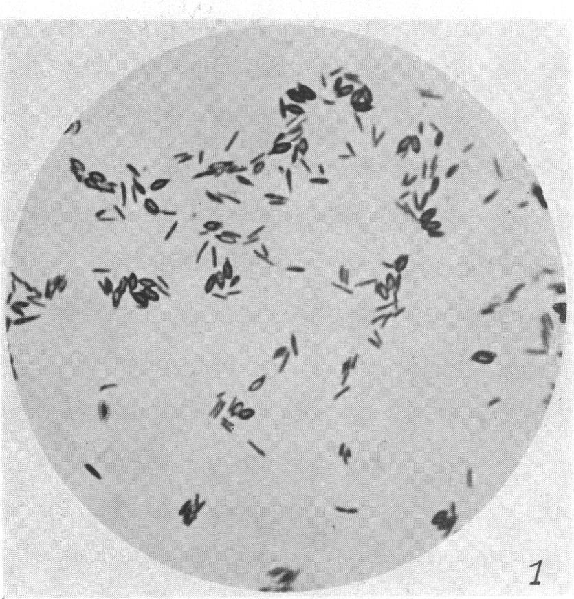 MICROORGANISMS WHICH DECOMPOSE CARBOHYDRATES 419 translucent. The white colonies produce spores; the gray ones are non-sporulating.
