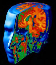 THE HUMAN BRAIN 1 in 4 people will have a brain disorder in their lifetime Brain injury Alzheimer's Depression Schizophrenia Developmental Epilepsy Drug addiction Number affected