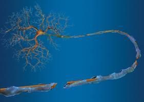 been damaged, interrupt communication Exposed nerve fibers