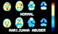 PET scans of the brain on marijuana Brookhaven National Laboratory Center for Imaging and