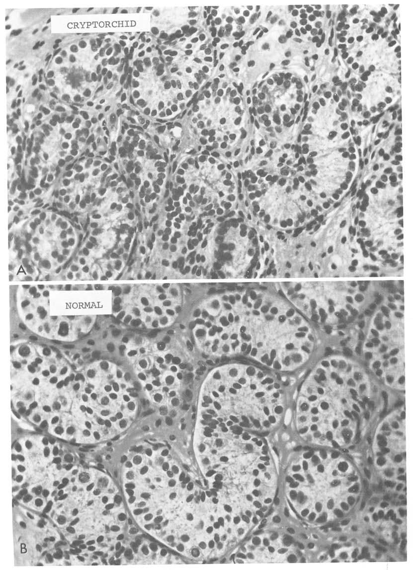 No differentiation of germ cells can be identified with certainty in the conventional histology.