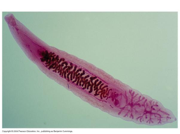 Helminthic Parasites of Humans Helminths are macroscopic, multicellular, eukaryotic worms Lack digestive system (or greatly reduced) Lacking or