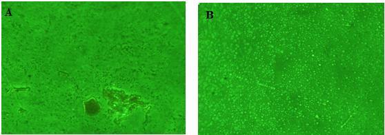 Figure 2: (A) 54 hour old early formed biofilm (Untreated); (B) 126 hour old Salinecontrol (Both as observed under a magnification of 40x using inverted Phase Contrast) Table 2 : Bacterial viability