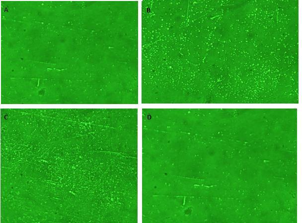 Figure 3: Biofilms exposed to most effective concentration of respective antimicrobials and observed under a magnification of 40x using Nikon TS-100 inverted eclipse microscope after 126 hours A: