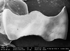 Moreover inlays were milled using the Sirona MC XL milling system in normal milling mode (see SEM