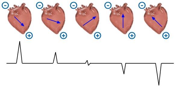 heart s depolarization pattern from a single plane Different leads allow you to see the pattern of depolarization from different angles Principles