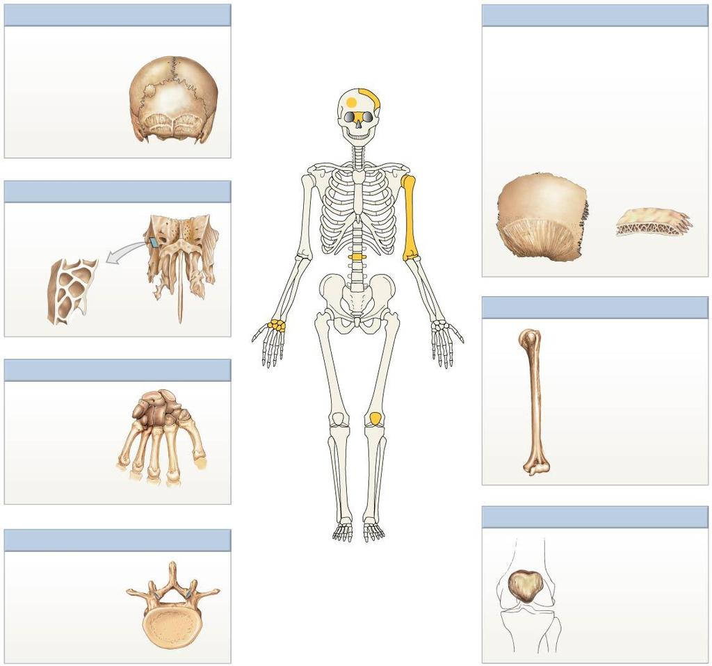 Figure 5.11 Shapes of Bones Sutural Bones Flat Bones Sutural (Wormian) bones are small, flat, oddly shaped bones found between the flat bones of the skull in the suture line.