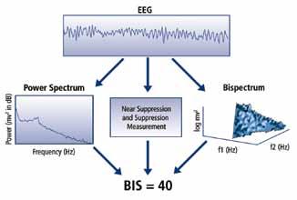 The BIS Index The BIS algorithm was developed to combine the EEG features (bispectral and others) which were highly correlated with sedation/hypnosis in the EEGs from more than 5,000 adult subjects.
