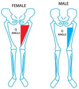 anatomic differences Patellofemoral Pain Syndrome Diffuse anterior knee pain Often worse with sitting with knee flexed for prolonged periods Also exacerbated