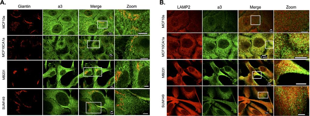 To assess whether a3 localizes to endosomal compartments, cells were fixed, permeabilized, and immunostained using antibodies against subunit a3 of the V-ATPase and EEA1 or Rab7 as markers for early