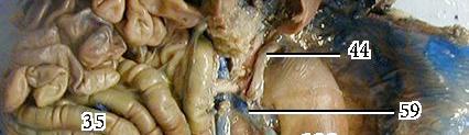 The umbilical vein carrys away waste products from the fetal pig's body (See Figure 4 on page 3 of