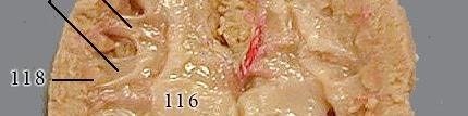 This pair of adrenal glands (#44 on figure 10) is not part of the excretory system, but the