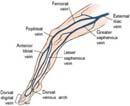 Most visible Most accessible Distal veins are least