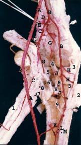 H) Dorsal carpal branches of radial artery. I) Palmar carpal branches of radial artery. J) Superficial palmar branch of radial artery. K) Deep palmar branch of radial artery. L) Deep palmar arc.