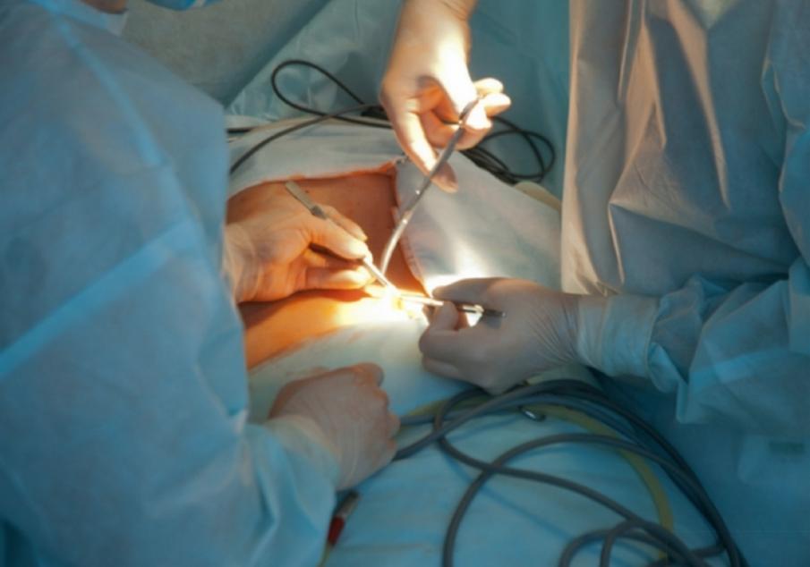 2. What Are The Options? Surgeons have been performing weight loss surgery since the 1950s.