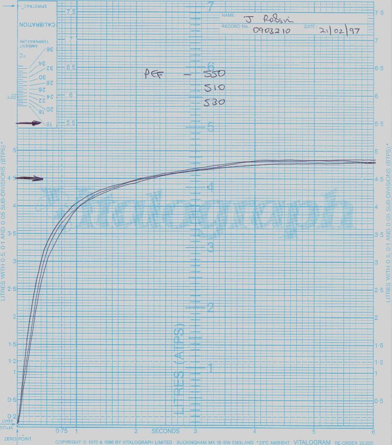 Normal Spirometric curve