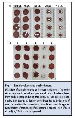 Monitoring pre analytic: sample quality Effect of Dried Bloodspot Quality on Newborn Screening Analyte Concentrations Roanna S. Georgeand Stuart J. Moat Clin Chem 2016 (P< 0.001).
