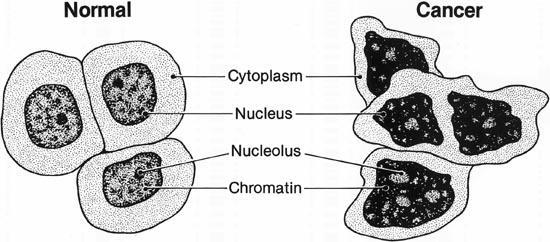 Cell Cycle Disorder: CANCER Cancer - the uncontrolled division (mitosis) of cells (cells can t stop making more cells; divides rapidly) Due