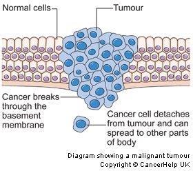 Cell Cycle Disorder: CANCER Cancer cells form masses of cells