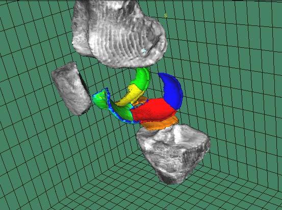 anatomical knee regions based on programmed atlas. 2.
