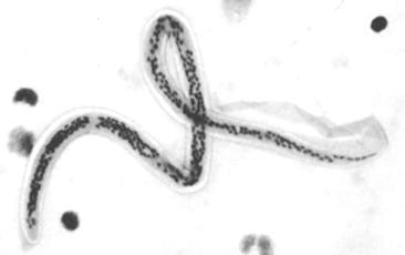 Fig.1 Filariasis: Mircrofilar