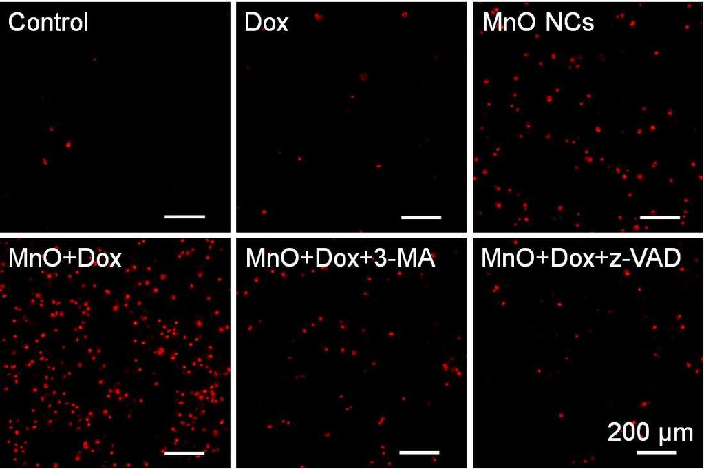 Combined treatment of MnO NCs and nonocytotoxic dose of Dox resulted in significant cell death, whereas 3-MA or z-vad-fmk attenuated it. HeLa cells were treated with Dox (.