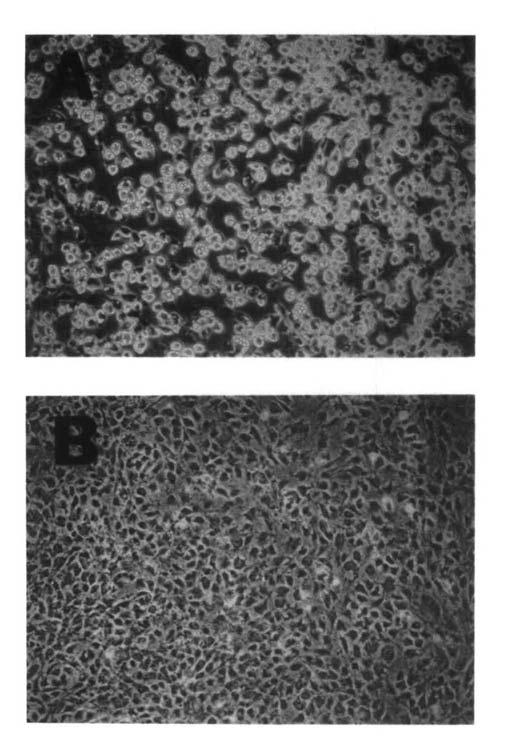 Cell extracts were prepared and acetylcoa carboxylase actvty determned. Error bars ndcate the range of two determnatons on duplcate cell monolayers. 30A5, mature adpocytes were treated wth 200 Uml.