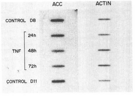 Total RNA was dotted onto ntrocellulose and probed wth antsense RNA probes derved from acetylcoa carboxylase cdna or actn cdna. The carboxylase flter (ACC) contans 1.7 ng RNA dot and the actn flter 0.