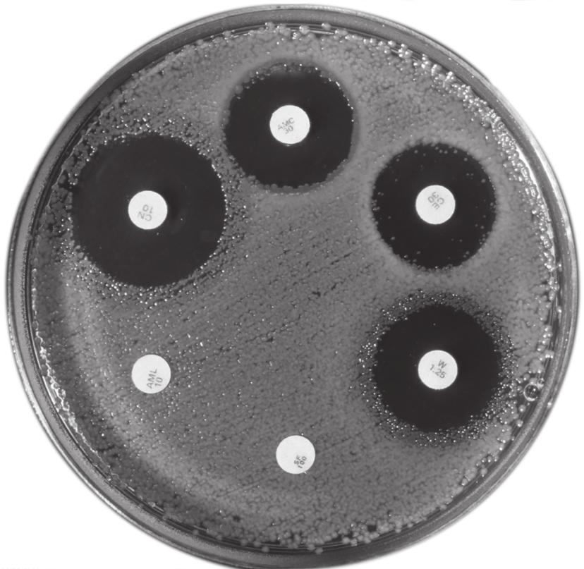 12 7 Fig. 7.1 shows bacteria growing on the surface of a dish containing nutrient jelly.