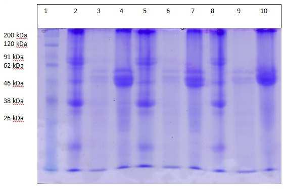 Fig. 1 Results of SDS-PAGE electrophoresis (1: marker; 2, 5, 8: SPI; 3, 6, 9: CPI dry; 4, 7, 10: CPI wet) Figure 1 shows that the SPI has 6 bands with molecular weight of protein fraction in a row is