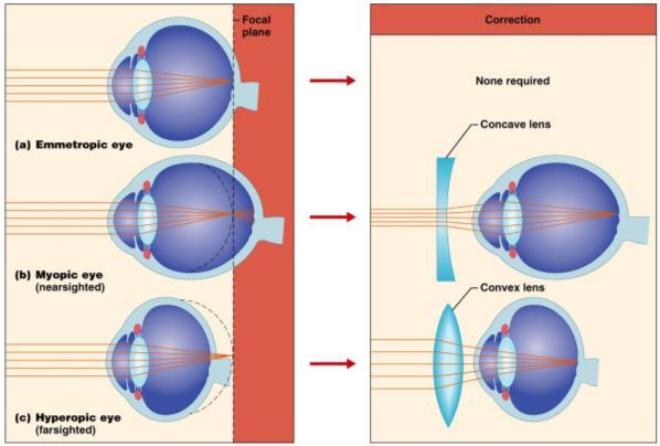VISION The eye is the sense organ for vision and converts light into electrical impulses Structure
