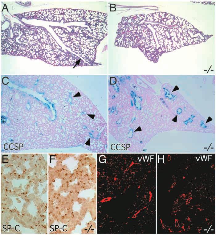 Lung hypoplasia in Fgf9-null mice 2101 Fig. 4. Immunohistochemistry for epithelial and vascular markers in E18.5 Fgf9 / lungs.