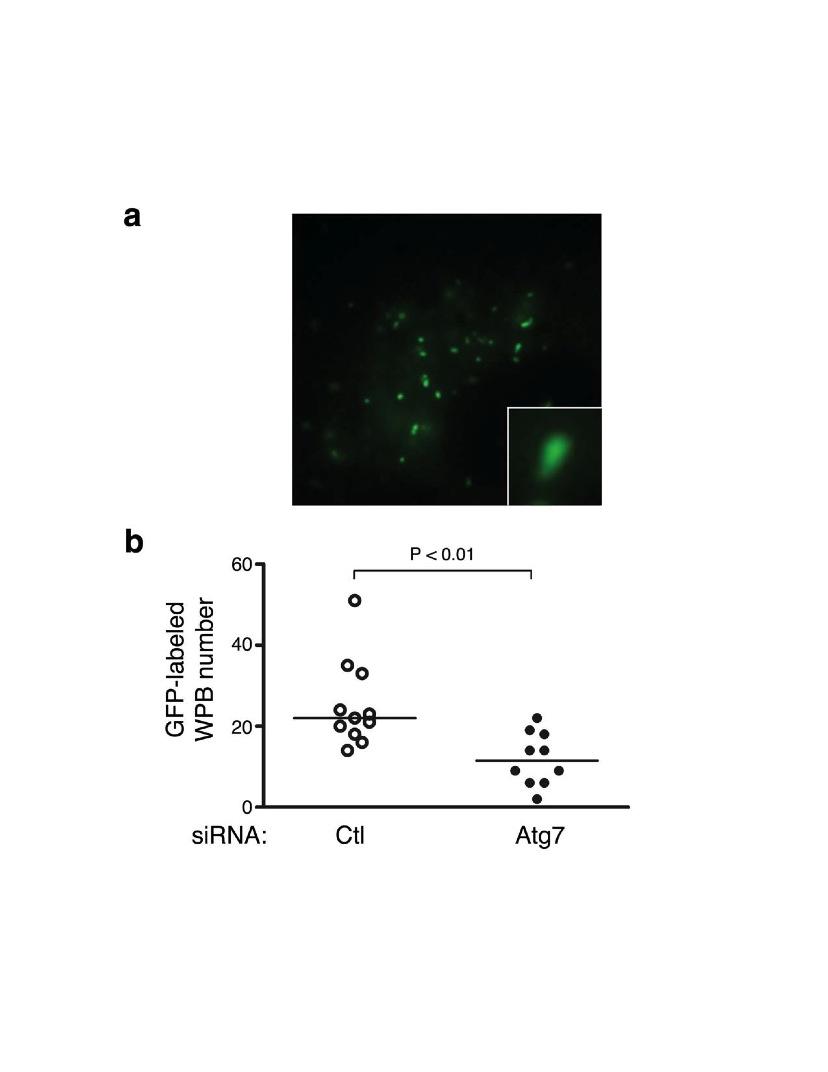 Figure 9: Analysis of secretion of WPBs containing VWF-GFP.