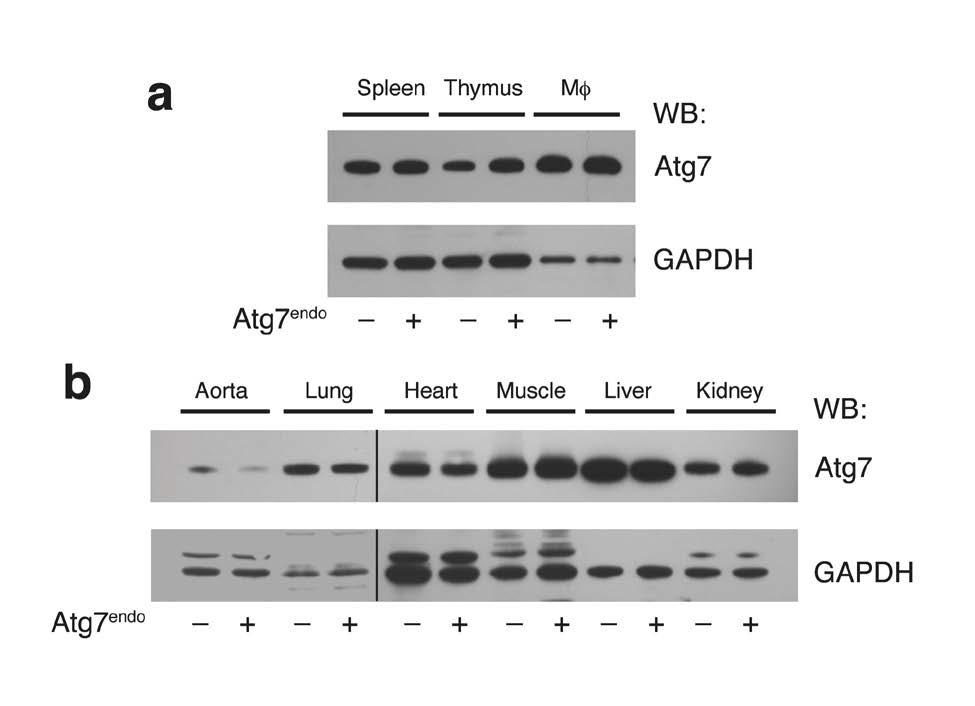 Figure 10: Atg7 expression in control or Atg7 endo mice. a) Atg7 levels in spleen, thymus or macrophages. b) Survey of Atg7 expression in various tissues.