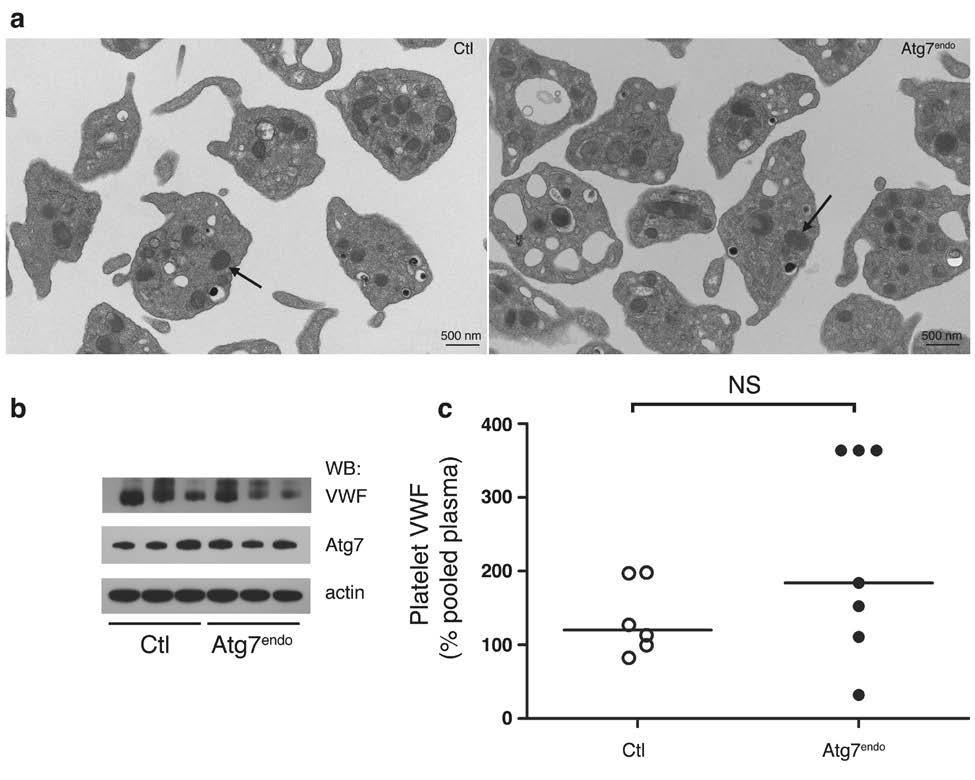 Figure 14: Deletion of Atg7 does not alter platelet VWF. a) Electron micrographs of control (left panel) and Atg7 endo platelets (right panel). Overall morphology was similar.