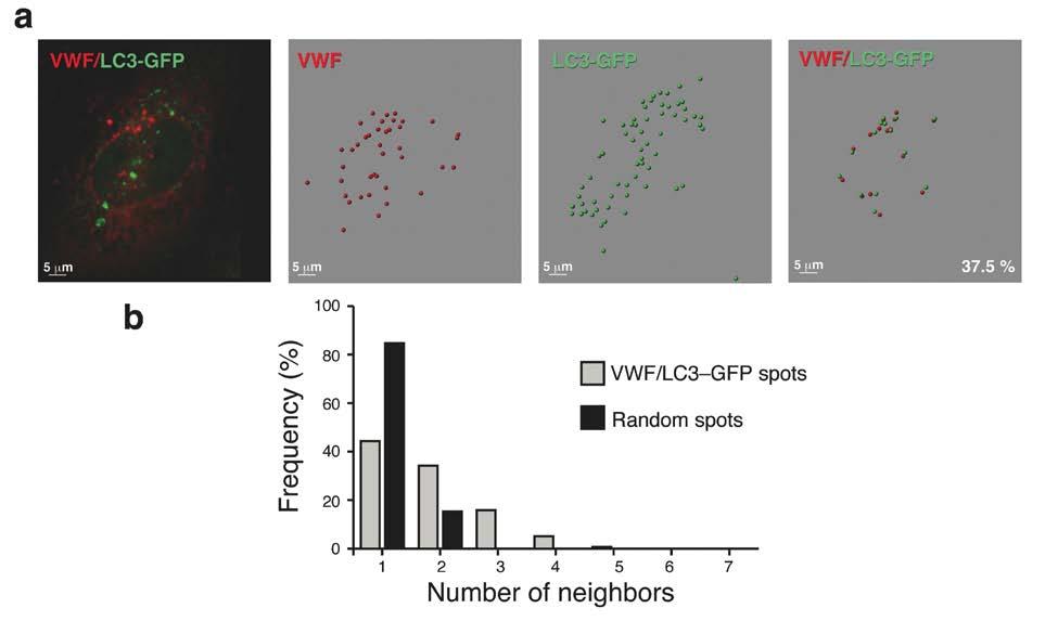 Figure 2: Clustering analysis of intracellular LC3 and VWF. a) Representative image analysis following immunofluorescent staining of human endothelial cells transfected with a LC3-GFP construct.
