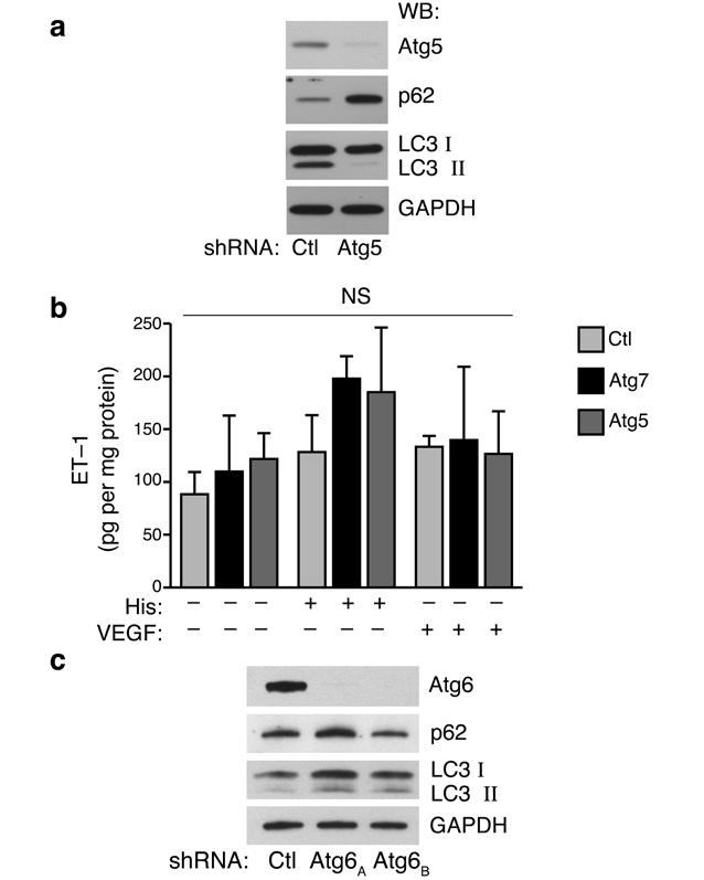 Figure 5: Western blot and functional analysis of Atg5, Atg6 and Atg7 knockdown. a) Western blot of human endothelial cells with control knockdown or following Atg5 shrna mediated knockdown.