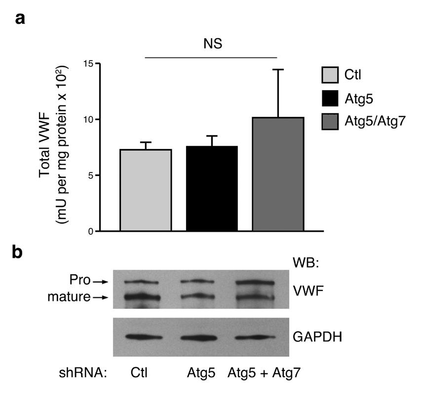 Figure 6: Effects of Atg7 and Atg5 on VWF. a) Intracellular VWF protein levels are not altered following knockdown of essential autophagy genes.