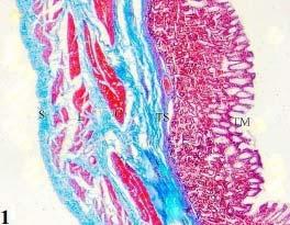 cells and diameter of nuclei of columnar epithelial cells were measured in cardiac, fundic and pyloric gland region (Table 2).