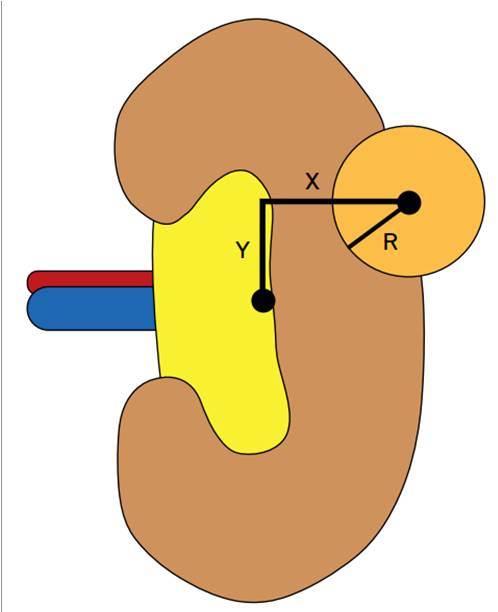 Fig. 7. C-index measures vertical (y) and horizontal (x) distance and tumor radius (R). The methodology of mathematical calculation of C-index allows determining properties of location of the tumor.