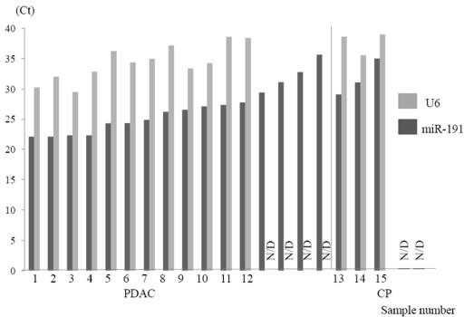 Figure 1. Expressions of RNA U6 (U6) and microrna-191 (mir- 191) in pancreatic juice samples.