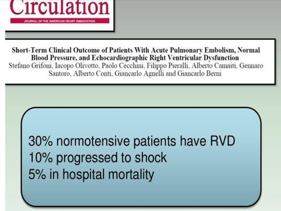 30% of normotensive PE have RV dysfunction 10 %