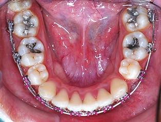 teeth (Fig. 8).