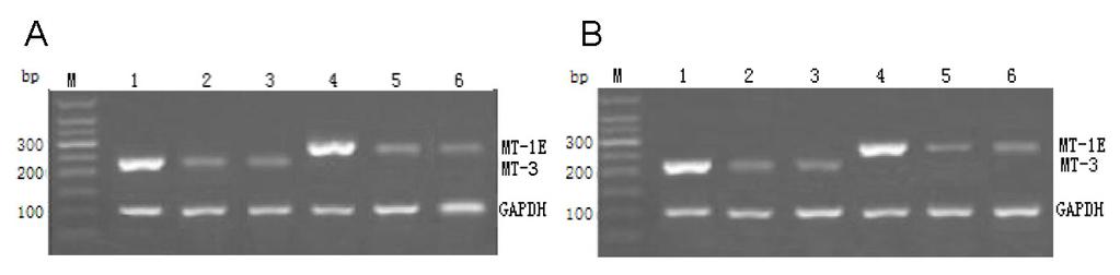 MT-3, MT-1E, and esophageal cancer 4599 MT-3 and MT-1E gene and mrna expression levels after transfection The semi-quantitative RT-PCR results showed that in contrast to the EX-T3737-M03- and