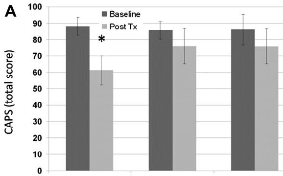 Paired TMS + Exposure Therapy in PTSD Isserles et al.