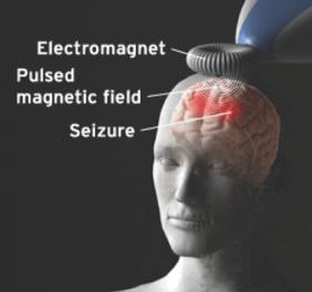 Transcranial Direct or Alternating Current ECT