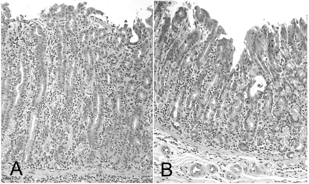 Figure 2.2: Photomicrographs of infected RAG2-KO recipients of B6 and 17AKO cells Figure 2.2: Hematoxylin and eosin stained sections of gastric fundus from H.
