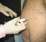 Injection technique Joint and soft tissue injections should be used in conditions that are clearly demarcated and well diagnosed and in which the injector is comfortable with the procedure.
