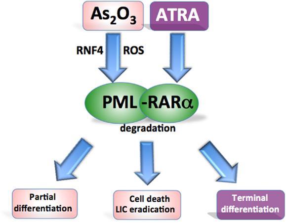 Acute Promyelocytic Leukemia PML-RARA