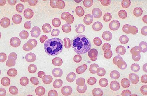 Neutrophilic granulocytes: 10-12 m in